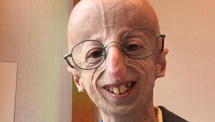 Addio a Sammy Basso, simbolo della progeria